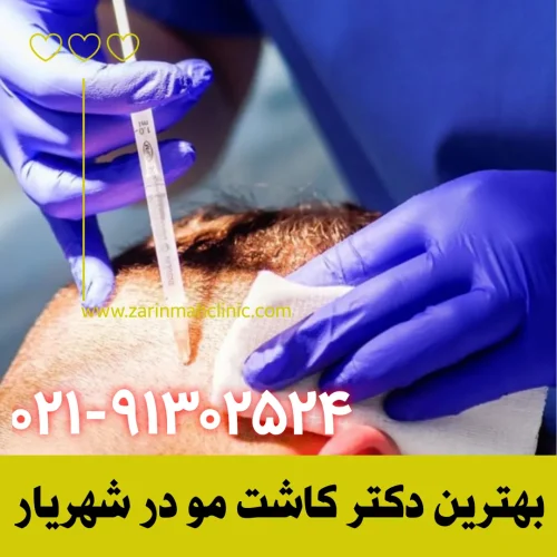 بهترین دکتر کاشت مو در شهریار