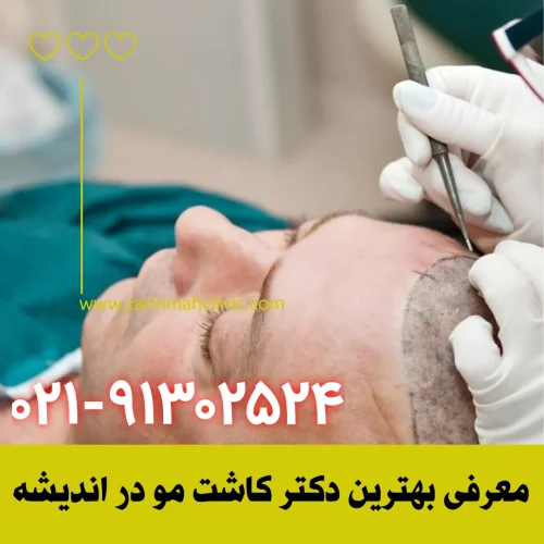 معرفی بهترین دکتر کاشت مو در اندیشه